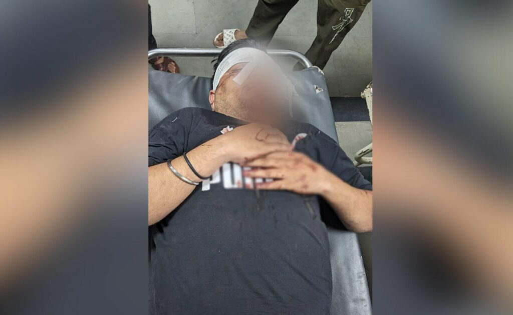 Rajasthan Man Loses Eye After Being Thrashed By Bouncer Over Rs 20 Ticket